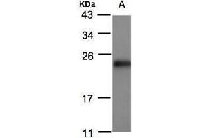 WB Image Sample(30 μg of whole cell lysate) A:MOLT4, 15% SDS PAGE antibody diluted at 1:500 (SRI Antikörper)