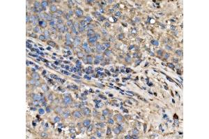 IHC analysis of RPL17 using anti-RPL17 antibody (ABIN7601639). (RPL17 Antikörper  (AA 40-167))