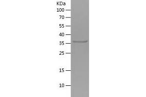 Western Blotting (WB) image for C-Type Lectin Domain Family 9, Member A (CLEC9A) (AA 100-209) protein (His tag) (ABIN7282342) (CLEC9A Protein (AA 100-209) (His tag))