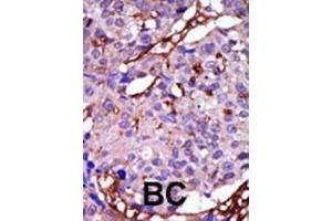 Immunohistochemistry (Paraffin-embedded Sections) (IHC (p)) image for anti-Calcium/calmodulin-Dependent serine Protein Kinase (MAGUK Family) (CASK) (AA 564-596), (C-Term) antibody (ABIN391318)