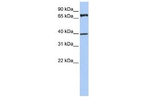 Western Blotting (WB) image for anti-Membrane Protein, Palmitoylated 5 (MAGUK P55 Subfamily Member 5) (MPP5) antibody (ABIN2458687) (MPP5 Antikörper)