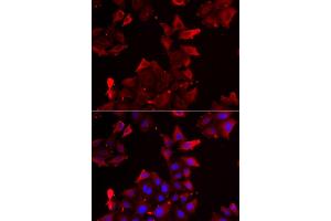 Immunofluorescence analysis of U2OS cells using PDLIM1 antibody (ABIN5974031). (PDLIM1 Antikörper)