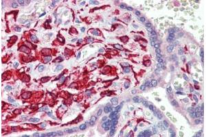 Immunohistochemistry (Paraffin-embedded Sections) (IHC (p)) image for anti-TEA Domain Family Member 1 (SV40 Transcriptional Enhancer Factor) (TEAD1) (C-Term) antibody (ABIN462220)