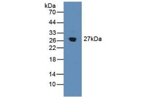 Detection of SDF4 in Mouse Pancreas Tissue using Polyclonal Antibody to Stromal Cell Derived Factor 4 (SDF4) (SDF4 Antikörper  (AA 184-382))