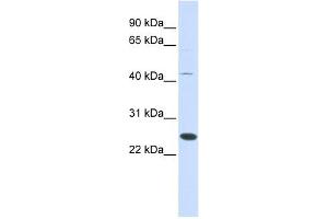 FAM119A antibody used at 1 ug/ml to detect target protein. (FAM119A Antikörper  (Middle Region))