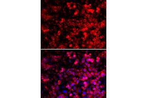 Immunofluorescence analysis of U2OS cells using QARS antibody. (QARS Antikörper  (AA 1-250))