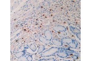IHC-P analysis of Human Stomach Tissue, with DAB staining. (TPSAB1 Antikörper  (AA 161-262))
