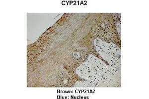 Sample Type : Monkey vagina  Primary Antibody Dilution :  1:25  Secondary Antibody: Anti-rabbit-HRP  Secondary Antibody Dilution:  1:1000  Color/Signal Descriptions: Brown: CYP21A2 Blue: Nucleus  Gene Name: CYP21A2  Submitted by: Jonathan Bertin, Endoceutics Inc. (CYP21A2 Antikörper  (C-Term))