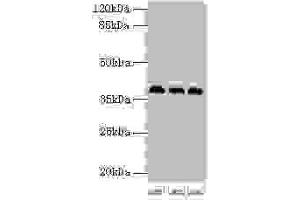 Western blot All lanes: HNRNPD antibody at 2 μg/mL Lane 1: 293T whole cell lysate Lane 2: Hela whole cell lysate Lane 3: Jurkat whole cell lysate Secondary Goat polyclonal to rabbit IgG at 1/10000 dilution Predicted band size: 39, 37, 33, 31 kDa Observed band size: 39 kDa (HNRNPD/AUF1 Antikörper  (AA 18-355))
