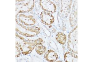 Immunohistochemistry of paraffin-embedded rat kidney using NEURL1B Rabbit pAb (ABIN7268857) at dilution of 1:100 (40x lens). (NEURL1B Antikörper)