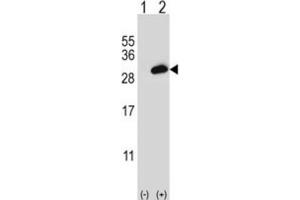 Western Blotting (WB) image for anti-Proteasome (Prosome, Macropain) Activator Subunit 2 (PA28 Beta) (PSME2) antibody (ABIN3002751) (PSME2 Antikörper)