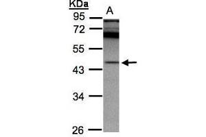 WB Image Sample(30 ug whole cell lysate) A:A431, 10% SDS PAGE antibody diluted at 1:2000 (SCPEP1 Antikörper)