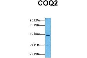 Host:  Rabbit  Target Name:  COQ2  Sample Tissue:  Human MCF7  Antibody Dilution:  1. (COQ2 Antikörper  (Middle Region))