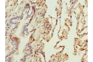 Immunohistochemistry of paraffin-embedded human lung tissue using ABIN7159816 at dilution of 1:100 (OGN Antikörper  (AA 20-298))