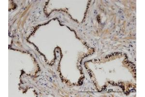 Immunoperoxidase of monoclonal antibody to ZHX3 on formalin-fixed paraffin-embedded human prostate. (ZHX3 Antikörper  (AA 863-955))