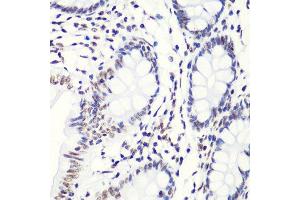 Immunohistochemistry (Paraffin-embedded Sections) (IHC (p)) image for anti-Histone H4 (2meLys20) antibody (ABIN3016048)