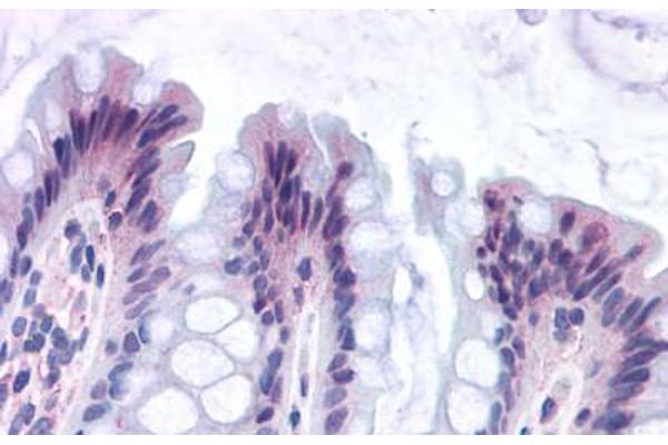 GPR82 Antikörper  (Cytoplasmic Domain)
