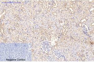 Immunohistochemical analysis of paraffin-embedded rat kidney tissue. (Collagen Type I Antikörper)