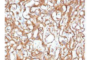 Formalin-fixed, paraffin-embedded human Placenta stained with Ezrin Mouse Monoclonal Antibody (CPTC-Ezrin-1). (Ezrin Antikörper)
