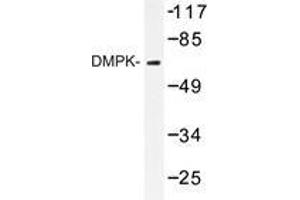 Western blot analysis of DMPK antibody in extracts from Jurkat cell. (DMPK Antikörper)