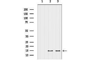anti-Small EDRK-Rich Factor 2 (SERF2) (N-Term) antibody