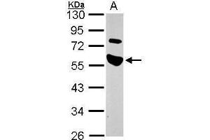 WB Image Sample (30 ug of whole cell lysate) A: A549 10% SDS PAGE antibody diluted at 1:1000 (TRAIP Antikörper)