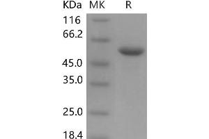 Western Blotting (WB) image for Carnosine Dipeptidase 1 (Metallopeptidase M20 Family) (CNDP1) (Active) protein (His tag) (ABIN7320096)