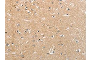 The image on the left is immunohistochemistry of paraffin-embedded Human brain tissue using ABIN7191635(NFASC Antibody) at dilution 1/30, on the right is treated with synthetic peptide. (NFASC Antikörper)