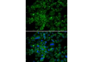 Immunofluorescence analysis of MCF-7 cells using CCL2 antibody (ABIN4903158). (CCL2 Antikörper)