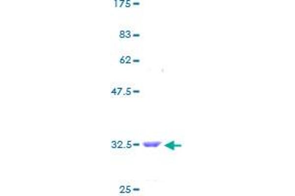 Thymosin beta 10 Protein (TMSB10) (AA 1-44) (GST tag)