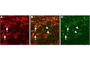 Expression of proNGF in rat brain sectionsImmunohistochemical staining of proNGF in rat brain sections using Anti-proNGF Antibody (ABIN7043556, ABIN7044751 and ABIN7044752). (Nerve Growth Factor (NGF) Peptid)