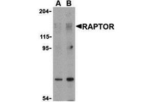 Western Blotting (WB) image for anti-RAPTOR (RAPTOR) (N-Term) antibody (ABIN1031532) (RAPTOR Antikörper  (N-Term))