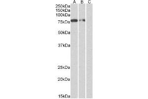 (1 µg/ml, right panel) staining of Multitag protein at 25 ng (A), 10 ng (B) and 5 ng (C) amounts. (Rekombinanter His Tag Antikörper)