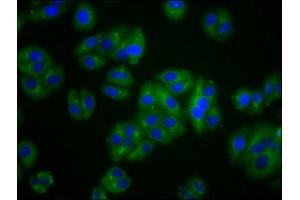 Immunofluorescence staining of HepG2 cells with ABIN7175437 at 1:100, counter-stained with DAPI. (VLDLR Antikörper  (AA 133-247))