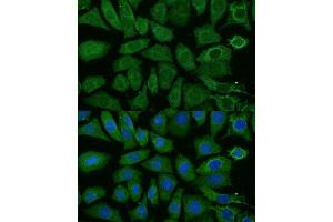 Immunofluorescence (IF) image for anti-NADH Dehydrogenase (Ubiquinone) 1 beta Subcomplex, 4, 15kDa (NDUFB4) (AA 1-90) antibody (ABIN6144476)