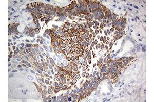 Immunohistochemistry (IHC) image for anti-Chromosome 3 Open Reading Frame 15 (C3orf15) (AA 1-313) antibody (ABIN2715591) (C3orf15 Antikörper  (AA 1-313))