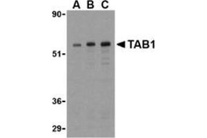 Western blot analysis of TAB1 in 3T3 cell lysate with this product at (A) 0. (TAB1 Antikörper  (Center))
