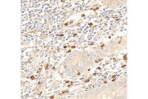 Immunohistochemistry (Paraffin-embedded Sections) (IHC (p)) image for anti-Interleukin-27 Subunit alpha (IL27) antibody (ABIN7074367)