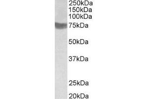 ABIN343748 (1µg/ml) staining of Human Skeletal Muscle lysate (35µg protein in RIPA buffer). (RNF139 Antikörper  (C-Term))