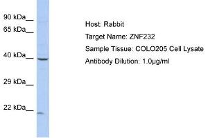 Host: Rabbit Target Name: ZNF232 Sample Type: COLO205 Whole cell lysates Antibody Dilution: 1. (ZNF232 Antikörper  (N-Term))