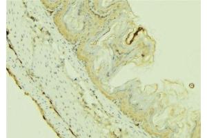ABIN6273655 at 1/100 staining Mouse colon tissue by IHC-P.