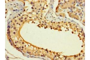 Immunohistochemistry of paraffin-embedded human testis tissue using ABIN7155297 at dilution of 1:100 (ASF1B Antikörper  (AA 1-202))