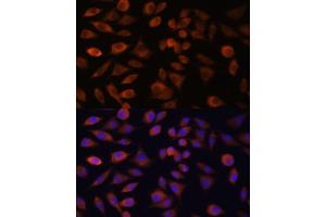 Immunofluorescence analysis of L929 cells using TRIM47 antibody (ABIN7270991) at dilution of 1:100. (TRIM47 Antikörper  (AA 356-530))
