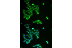 Immunofluorescence analysis of U2OS cells using PJA2 antibody (ABIN5973844). (PJA2 Antikörper)