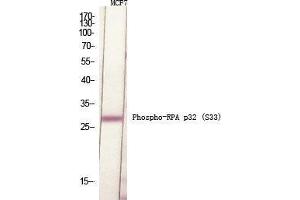 Western Blot (WB) analysis of specific cells using Phospho-RPA p32 (S33) Polyclonal Antibody.