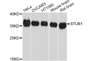 Western blot analysis of extracts of various cell lines, using STUB1 Antibody. (STUB1 Antikörper  (AA 1-303))