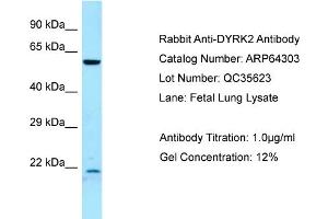 Western Blotting (WB) image for anti-Dual-Specificity tyrosine-(Y)-phosphorylation Regulated Kinase 2 (DYRK2) (C-Term) antibody (ABIN2789799) (DYRK2 Antikörper  (C-Term))