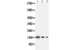 Anti-IL-4 antibody, (ABIN3042695), Western blottingLane 1: Recombinant Human IL-4 Protein 10 ngLane 2: Recombinant Human IL-4 Protein 5 ngLane 3: Recombinant Human IL-4 Protein 2.