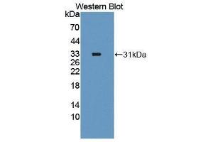 Western Blotting (WB) image for anti-Forkhead Box O1 (FOXO1) (AA 333-557) antibody (ABIN3207927) (FOXO1 Antikörper  (AA 333-557))