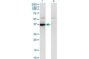 Western Blot analysis of PANK1 expression in transfected 293T cell line by PANK1 polyclonal antibody (A01).